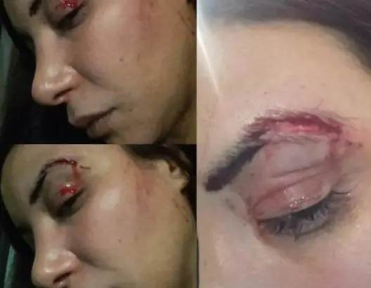 لبنى أبيضار تتعرض لاعتداء بالدار البيضاء