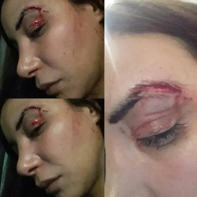 لبنى أبيضار تتعرض لاعتداء بالدار البيضاء