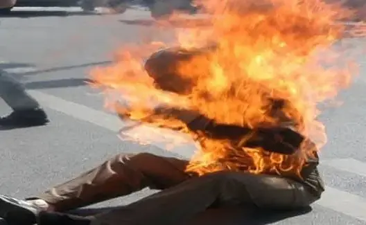توقيف معتدين أضرموا النار في شخص بالبيضاء