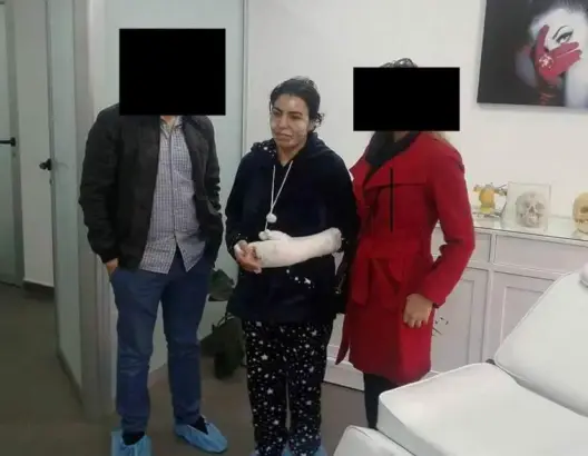 طبيب يتكفل بعملية تجميل وجه فتاة تطوان المعتدى عليها