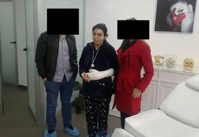 طبيب يتكفل بعملية تجميل وجه فتاة تطوان المعتدى عليها