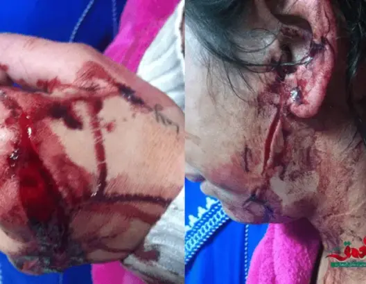 اعتداء شينع على فتاة بتامنصورت والدرك يبحث عن الجناة