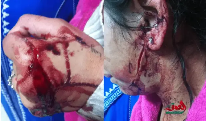 اعتداء شينع على فتاة بتامنصورت والدرك يبحث عن الجناة