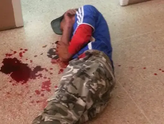 سجين سابق يحاول قطع يده داخل مقر بلدية أكادير