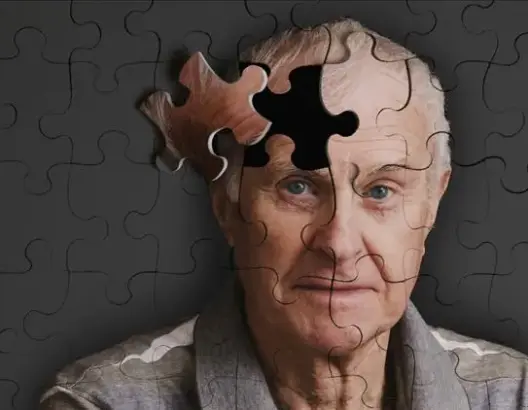 علماء روس يكتشفون طريقة جديدة مبدئيا لعلاج مرض الزهايمر