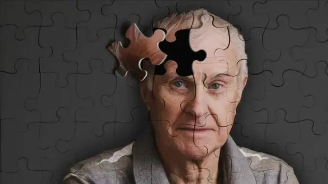 علماء روس يكتشفون طريقة جديدة مبدئيا لعلاج مرض الزهايمر