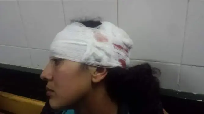 صور صادمة من التدخل الأمني “العنيف” في حق الأساتذة المتدربين (صور)