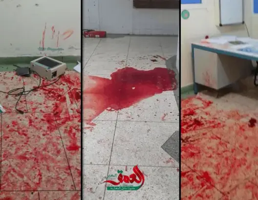الوردي يدعو لحماية المؤسسات الصحية بعد الاعتداء على مستشفى مكناس