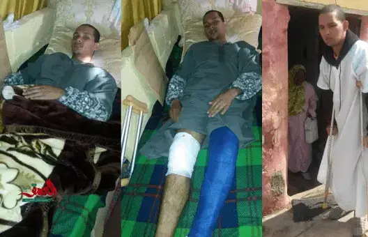 مركز حقوقي يطالب الداخلية بالتحقيق في اعتداء عون سلطة على مواطن بسلا