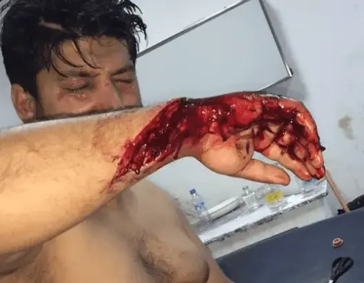 احتجاجات بطنجة بعد اعتداء بالسيوف و”الما القاطع” على حارس ليلي