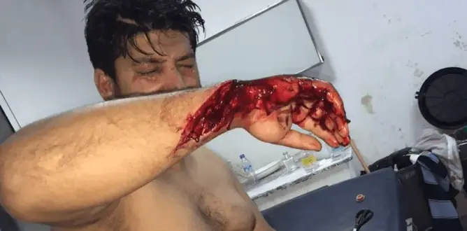 احتجاجات بطنجة بعد اعتداء بالسيوف و”الما القاطع” على حارس ليلي
