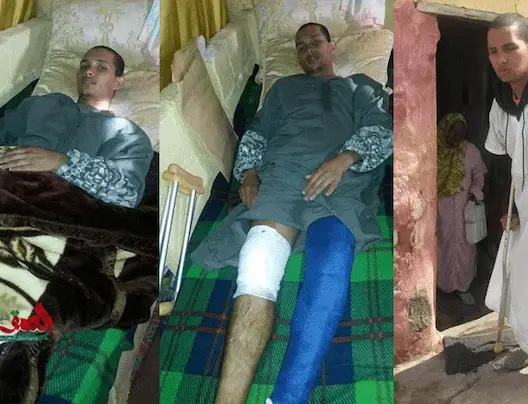 عون سلطة يكسر رجلي مواطن بسلا بسبب رفضه “شهادة زور”