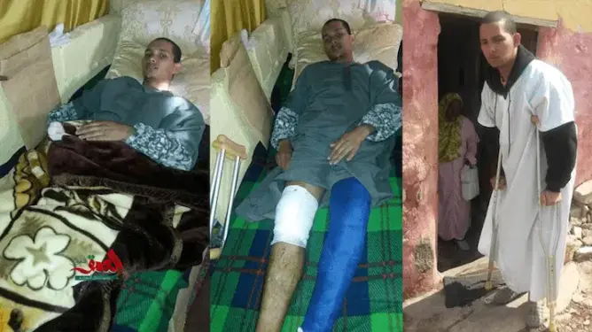 عون سلطة يكسر رجلي مواطن بسلا بسبب رفضه “شهادة زور”