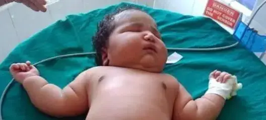 أكبر مولودة في العالم وزنها 6.8 كلغم.. كيف كانت ولادتها؟