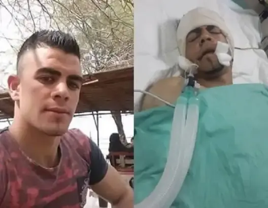 استشهاد فلسطيني متأثرا بإصابته برصاص الاحتلال