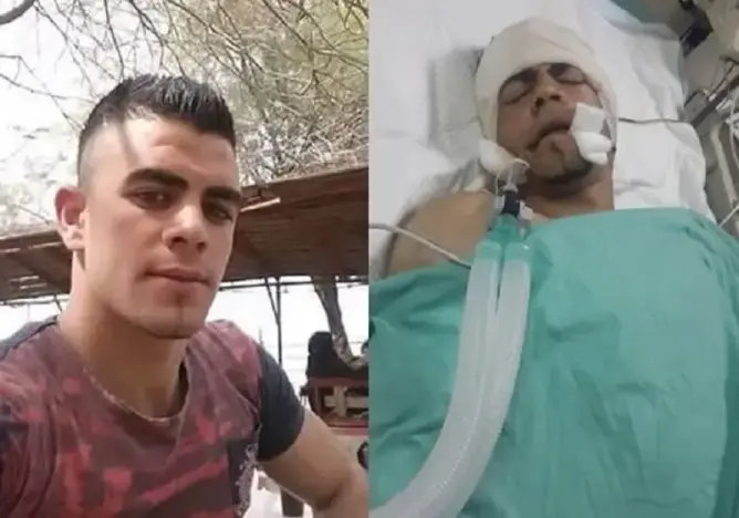 استشهاد فلسطيني متأثرا بإصابته برصاص الاحتلال