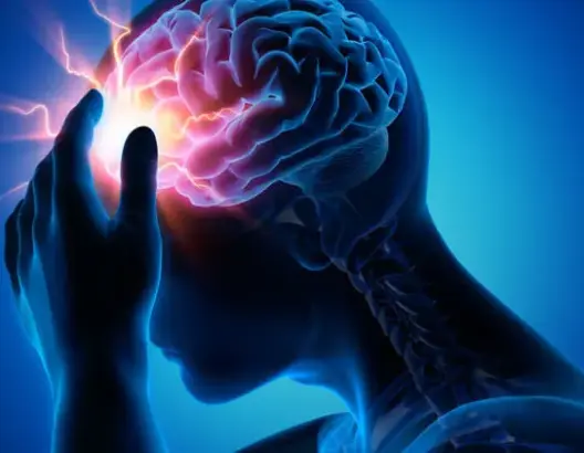 90% من حالات الإصابة بسكتة الدماغ يمكن تجنبها