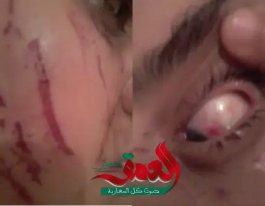 خطير..نساء تختطفن سيدة ويغتصبنها