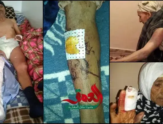 عائلة بآسفي تشتكي من “تلاعب” القضاء في ملف يتعلق بمحاولة قتل