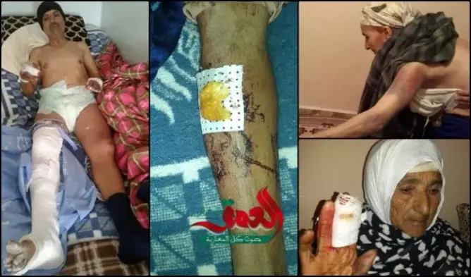 عائلة بآسفي تشتكي من “تلاعب” القضاء في ملف يتعلق بمحاولة قتل