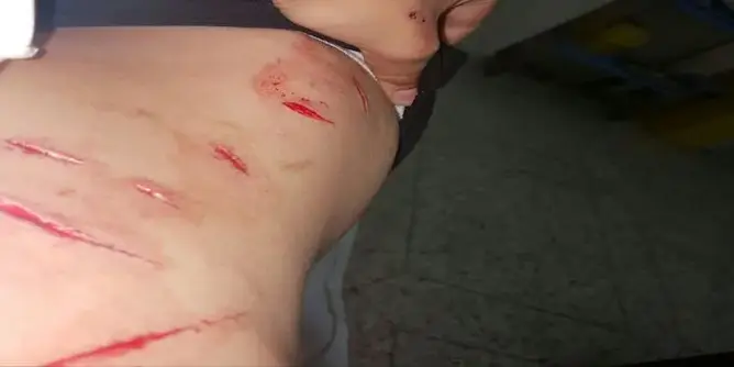 “البام” يستنكر الاعتداء على مرشحته بفاس ويطالب بالتحقيق