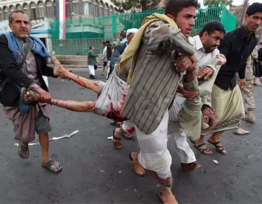 مقتل 14 حوثيا من ضمنهم قيادات ميدانية باليمن