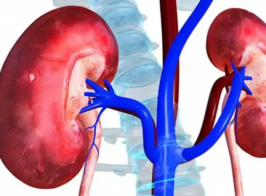 هذه العادات تدمر الكلى وتصيبها بالتليف احذرها