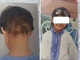 “دواعش” في وزرة بيضاء..