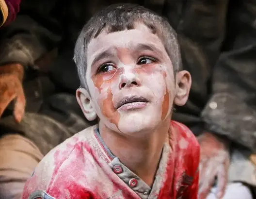 مأساة حلب تَصفع حكام العرب وتُعري المنتظم الدولي من حَمالة الحَطب