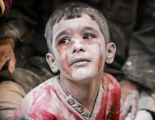 حلب بداية نصر منقوص