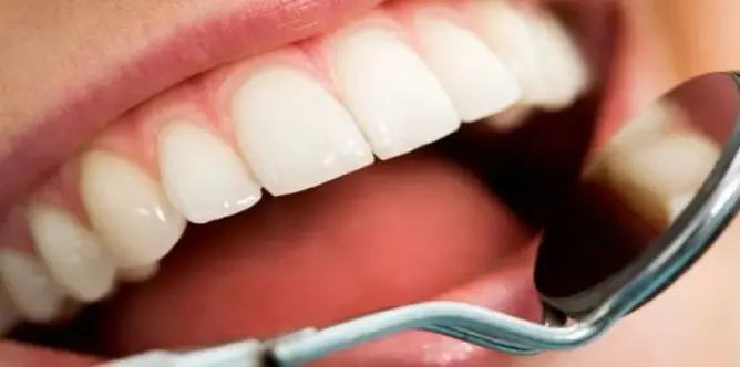 اكتشاف علاج جديد للحد من تلف الأسنان