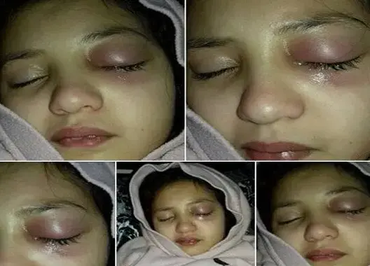 الطب الشرعي يتوصل إلى سبب وفاة التلميذة التي عنفتها معلمتها بمكناس