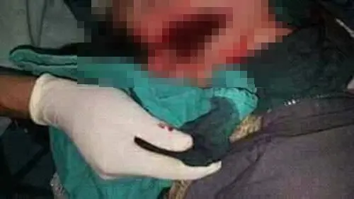 لص يشرمل فتاة ويرسلها إلى المستشفى بالرشيدية