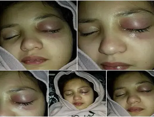 مكناس: وفاة تلميذة بسبب التعنيف من مدرستها