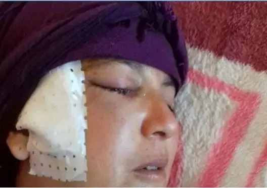 حقوقيون ببني ملال يطالبون باعتقال شخص حاول قتل زوجته (فيديو)