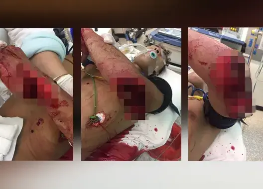 خطير .. القضاء يفرج عن متهم حاول قتل شخص بسيف في الرباط