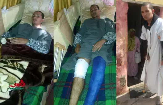 حتوان ضحية اعتداء عون سلطة بسلا يفارق الحياة بعد عام من الإهمال