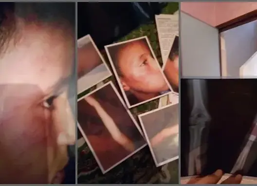 أستاذ يعنف تلميذا بطريقة وحشية بمدرسة بتنغير (صور)