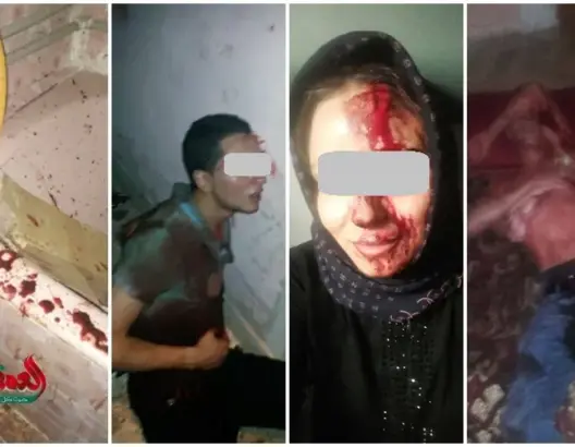 خطير.. اعتداء بالسيوف يرسل أسرة بكاملها للمستشفى بطنجة (فيديو)