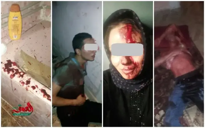 خطير.. اعتداء بالسيوف يرسل أسرة بكاملها للمستشفى بطنجة (فيديو)