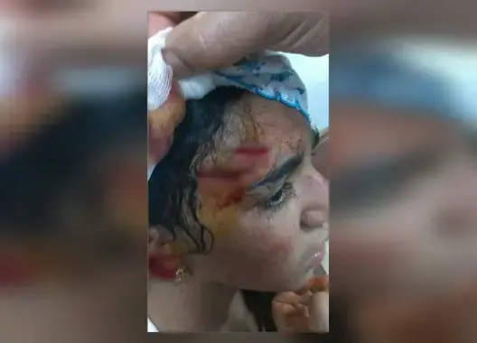 اعتداء مروع بالأسلحة البيضاء على طفلة بالرباط ودعوات بتدخل الأمن