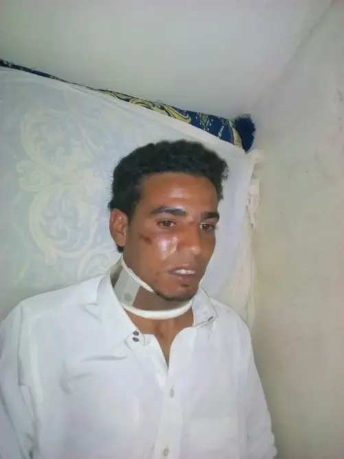 اعتداء شنيع على شاب بالقنيطرة والجناة خارج المحاسبة (فيديو وصور)