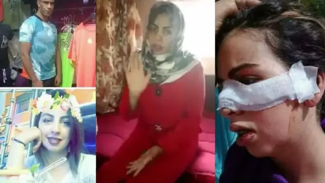 أول فيديو الفتاة اللي تم الإعتداء عليها من طرف صديقها القديم