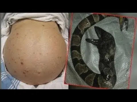 تضع مسامير في بطنها لكي يهدأ الكائن الذي بداخلها وعند الكشف عليها كانت الصدمه !!