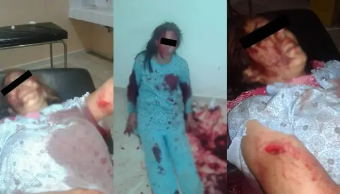 بعد رفضها الزواج منه.. شاب “يشرمل” قاصر بالسلاح الأبيض بسطات