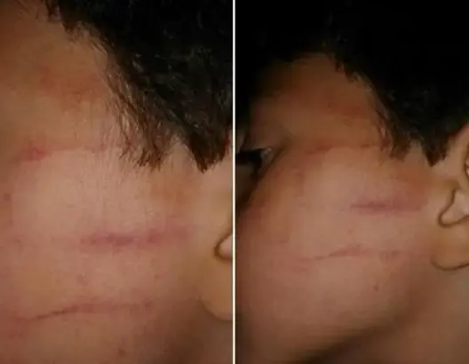 وزارة حصاد توقف أستاذة بطنجة “عنفت” تلميذا وأثارت غضبا “فيسبوكيا”