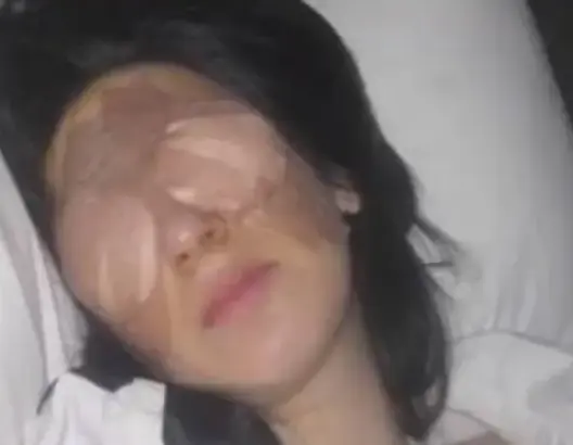 مرض نادر وغريب.. عينا هذه المرأة تقفلان 3 أيام متتالية! (فيديو)