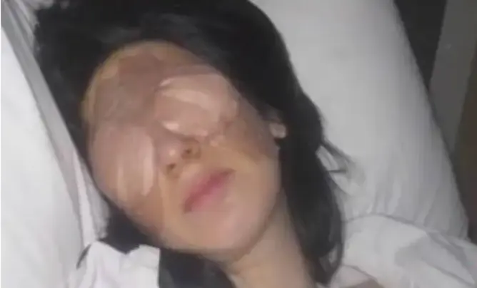 مرض نادر وغريب.. عينا هذه المرأة تقفلان 3 أيام متتالية! (فيديو)