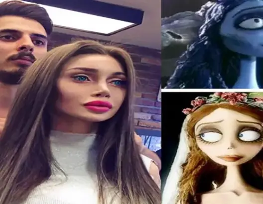 فتاة تزيل 6 من أضلاعها لتصبح “أميرة كرتون” !