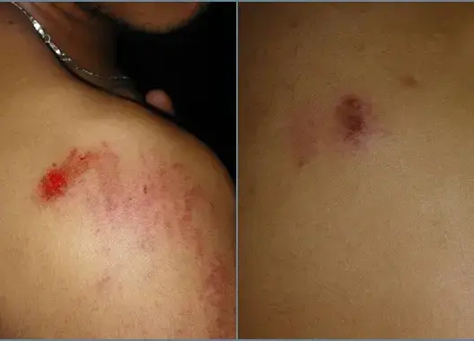 تعنيف واعتقال 18 محتجا ضد أزمة العطش بزاكورة (فيديو)
